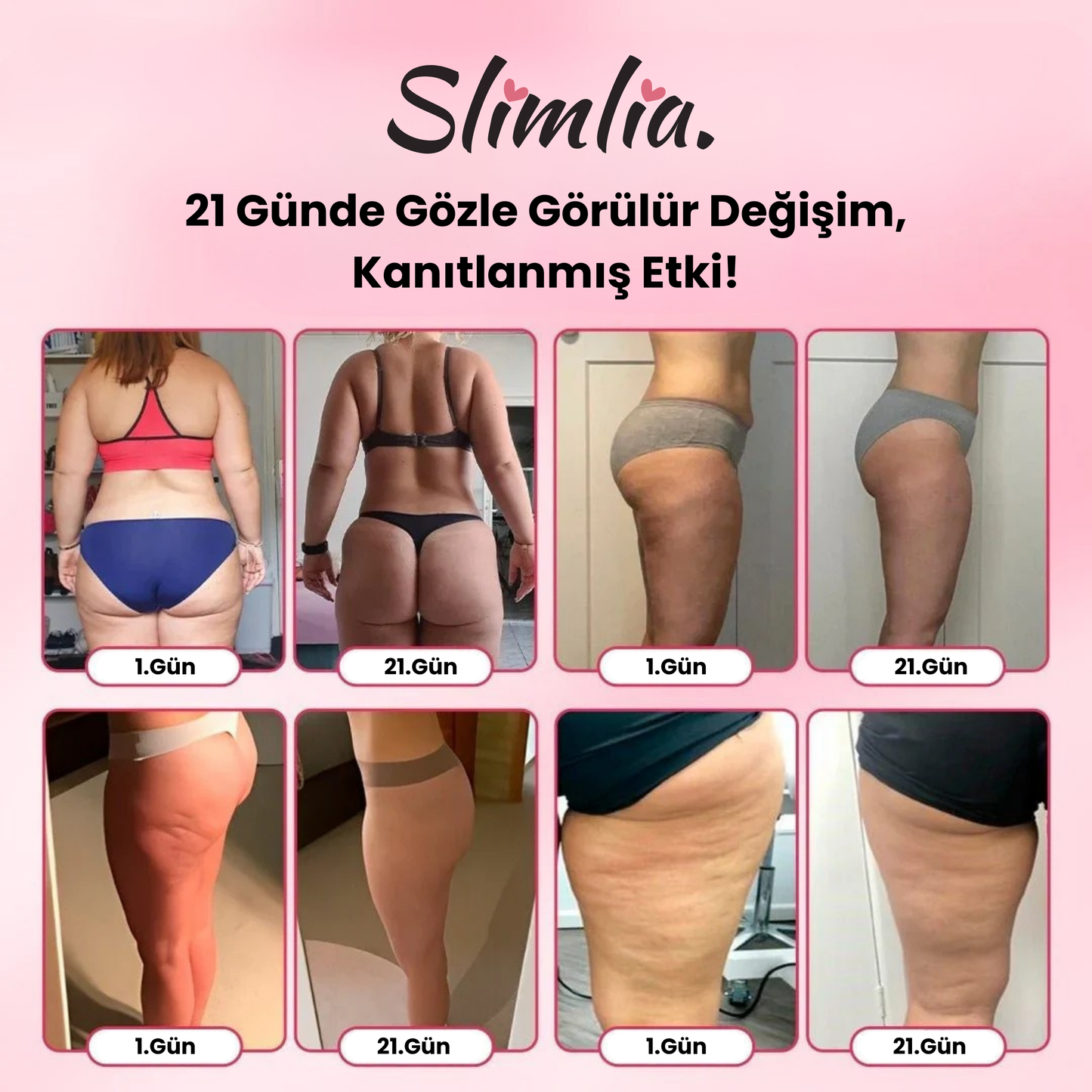 Slimlia™ Selülit Karşıtı Masaj Aleti